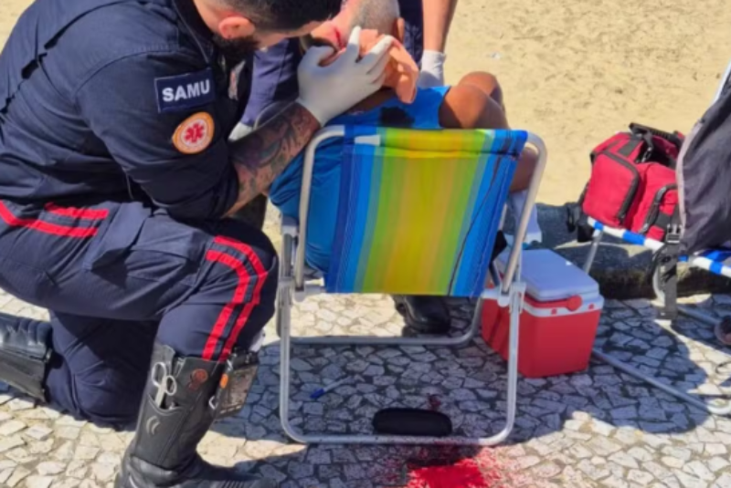 Um idoso de 67 anos foi atingido por uma pedrada na cabeça enquanto observava o mar, sentado em uma cadeira de praia, na orla do