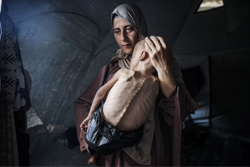 A dramática imagem do pequeno Mohamed Zakariya Ayyoub al-Matouq, de apenas um ano e meio, tornou-se símbolo da fome extrema na Faixa de Gaza.