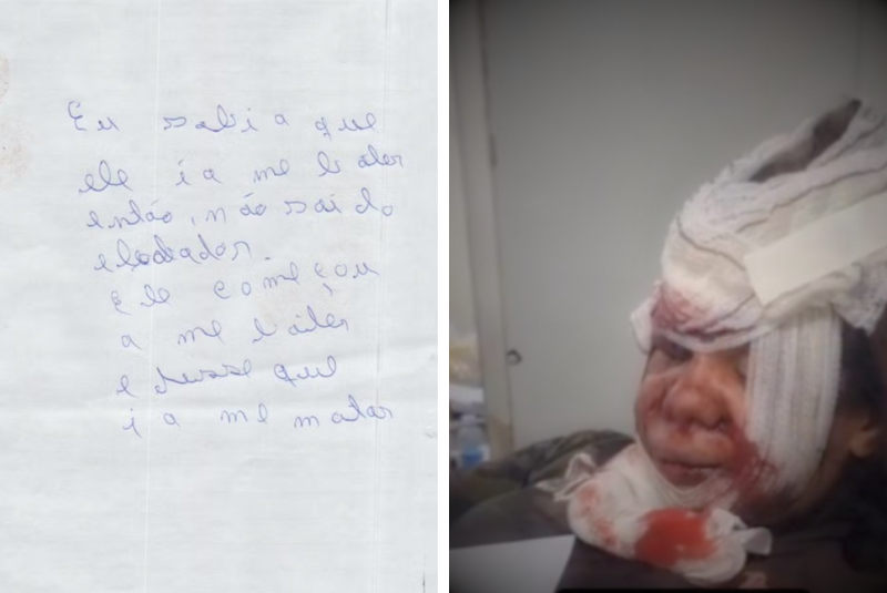 A mulher de 35 anos brutalmente agredida pelo namorado no elevador de um condomínio em Ponta Negra, na Zona Sul de Natal (RN),