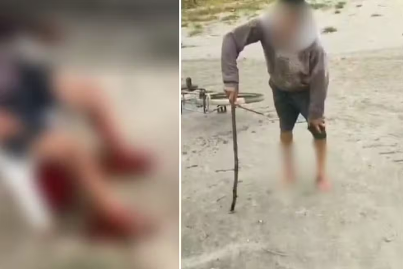 Um homem de 58 anos foi atacado por três cachorros na Praia do Perequê, em Guarujá, no litoral de São Paulo, na última sexta-feira (15).