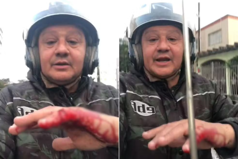 Um motociclista ficou ferido após ser atingido por uma linha de pipa com cerol em São Vicente, no litoral de São Paulo.