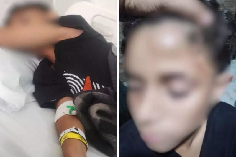 Aluno é agredido dentro de escola e sofre traumatismo craniano em Santos
