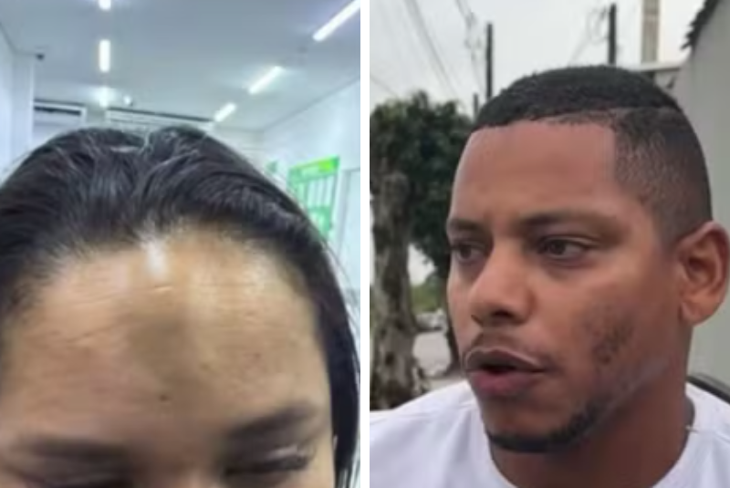 Turista baleado por policial penal em quiosque de Praia Grande acusa agressão e assédio contra esposa