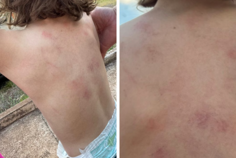 Mãe denuncia agressão contra criança autista na Apae de Ituiutaba; Polícia Civil investiga