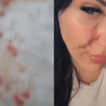 Mulher é atacada...