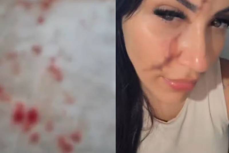 Uma cabeleireira e manicure de 33 anos foi atacada com um pedaço de vidro após tentar intervir em uma briga entre crianças...