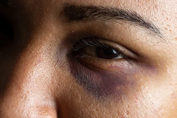 Violencia Contra Mulher Foto: Reprodução