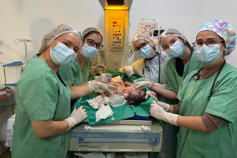 Bebês siameses nascem em Goiânia unidos pelo abdômen e passam bem na UTI