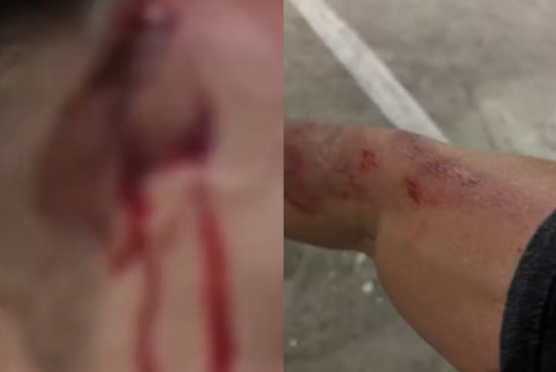Um guarda-vidas de 35 anos foi assaltado enquanto andava de bicicleta após o expediente em Guarujá, no litoral de São Paulo.