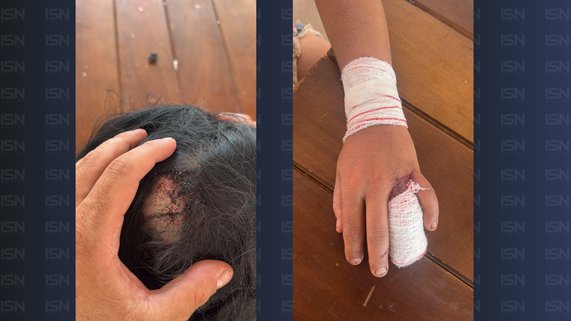 Mulher sofre agressões e perde parte do dedo em Uberaba