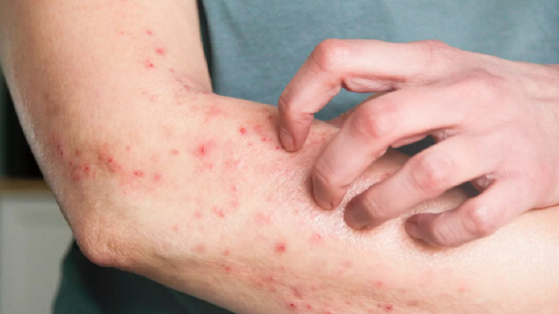 Captura de tela 2025-10-29 113632 Foto: Reprodução internet