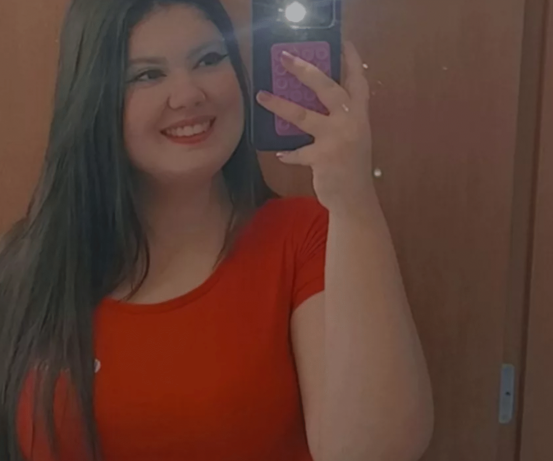 Danielle Silvestre teve 90% do corpo queimado