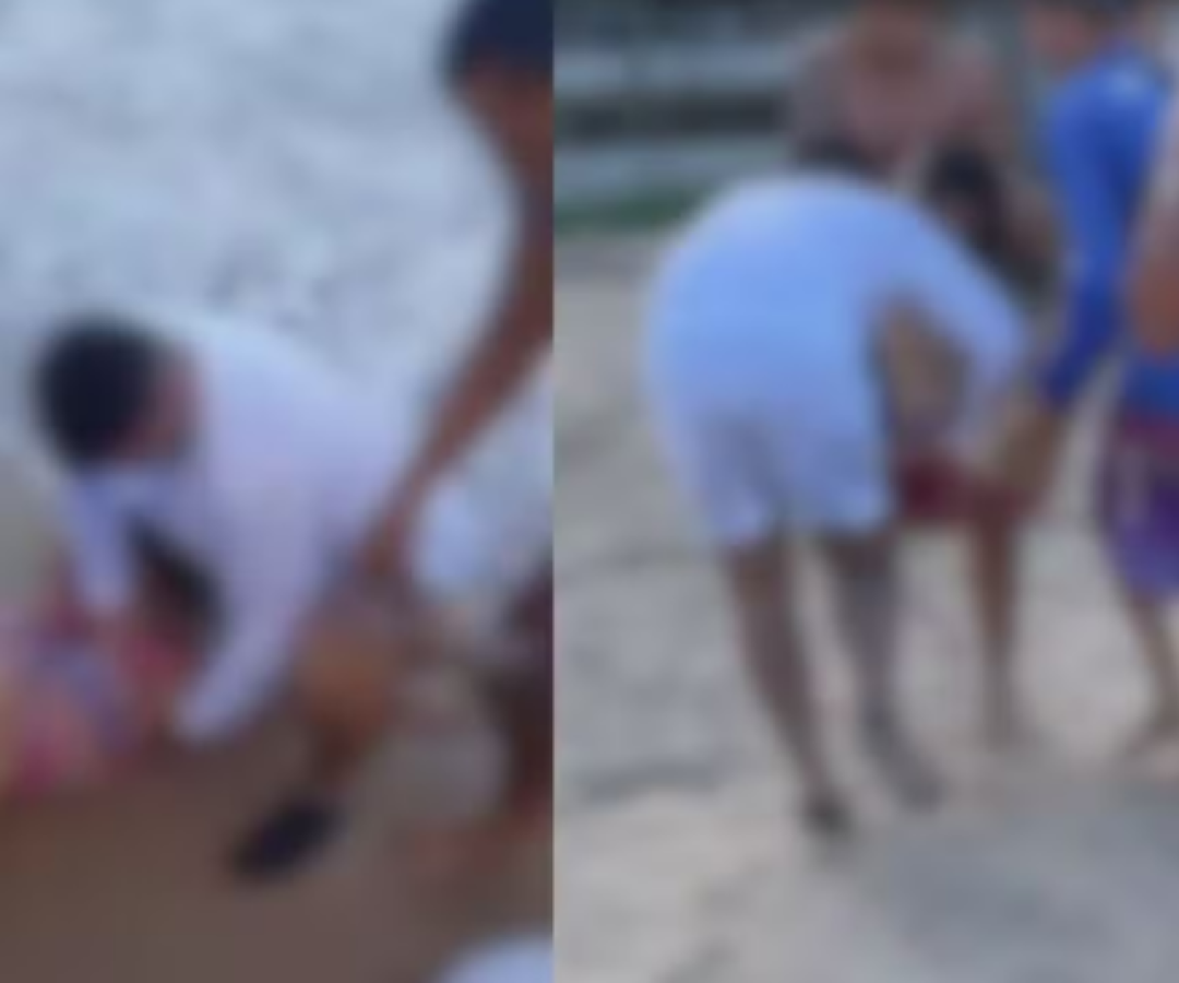 Tubarão arranca perna de jovem em Boa Viagem; é o 2º caso em dois dias