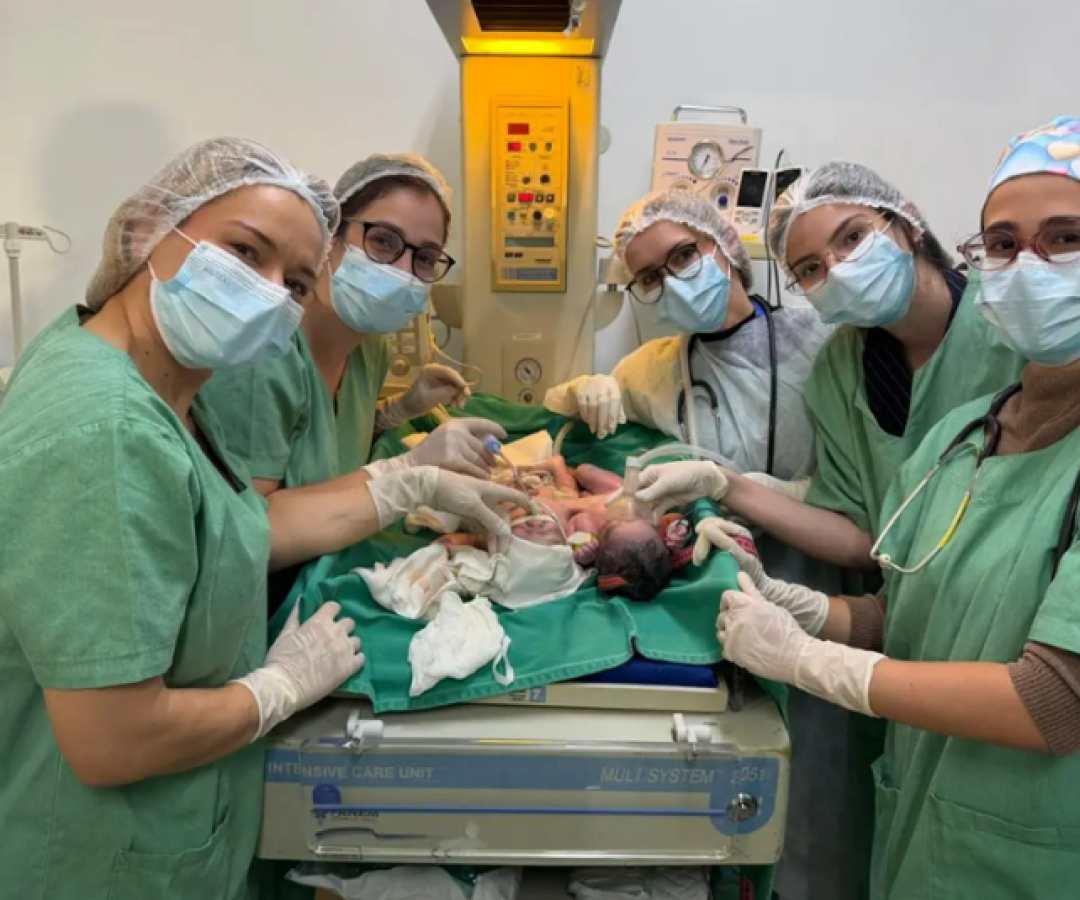 Bebês siameses nascem em Goiânia unidos pelo abdômen e passam bem na UTI