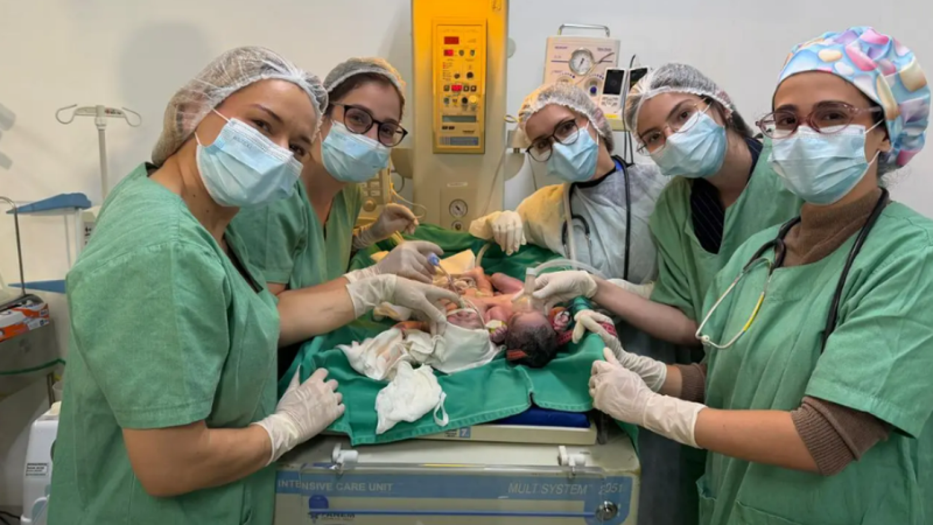 Bebês siameses nascem em Goiânia unidos pelo abdômen e passam bem na UTI