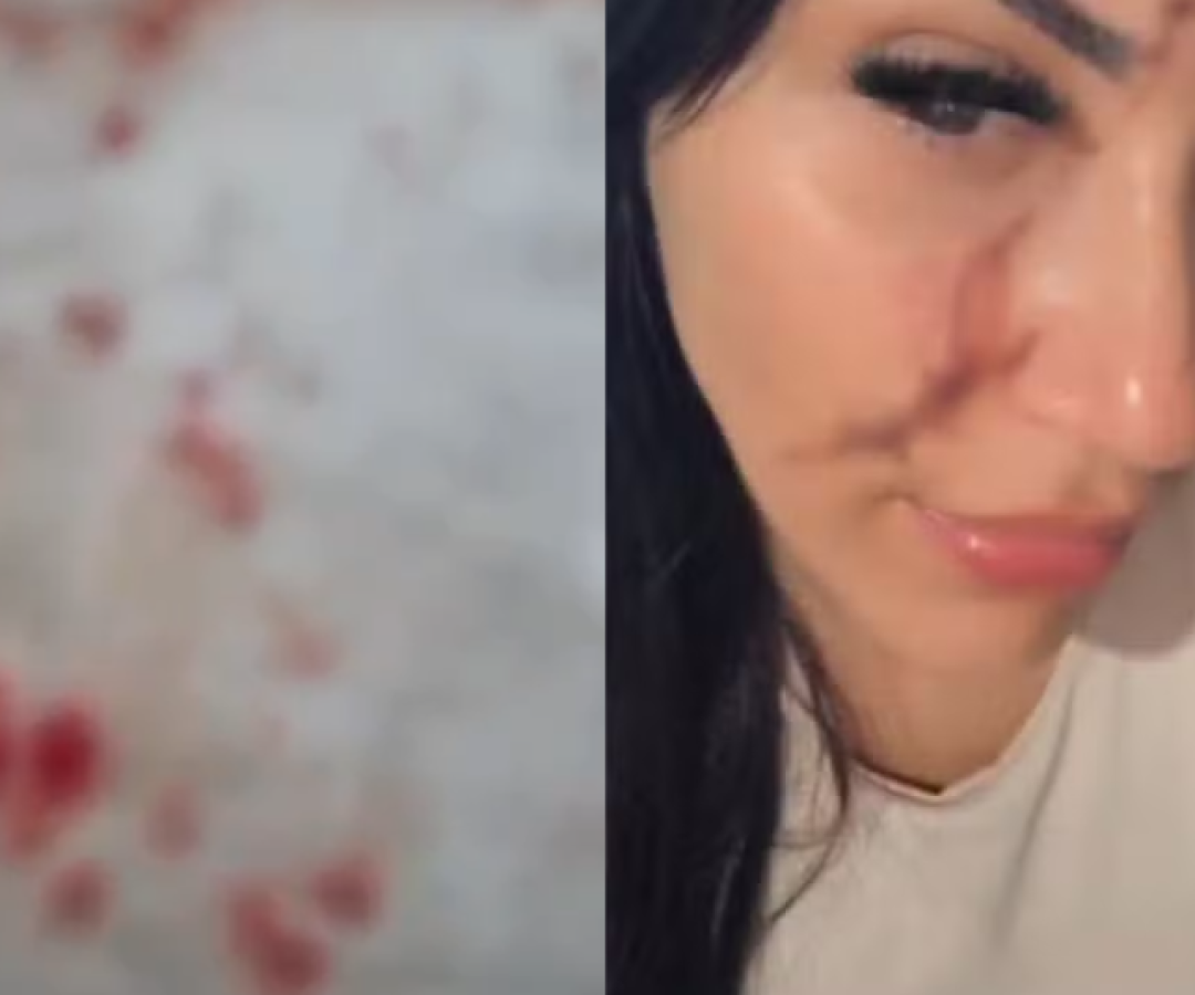 Uma cabeleireira e manicure de 33 anos foi atacada com um pedaço de vidro após tentar intervir em uma briga entre crianças...