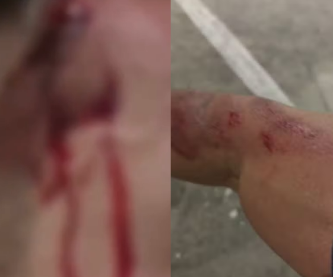 Um guarda-vidas de 35 anos foi assaltado enquanto andava de bicicleta após o expediente em Guarujá, no litoral de São Paulo.