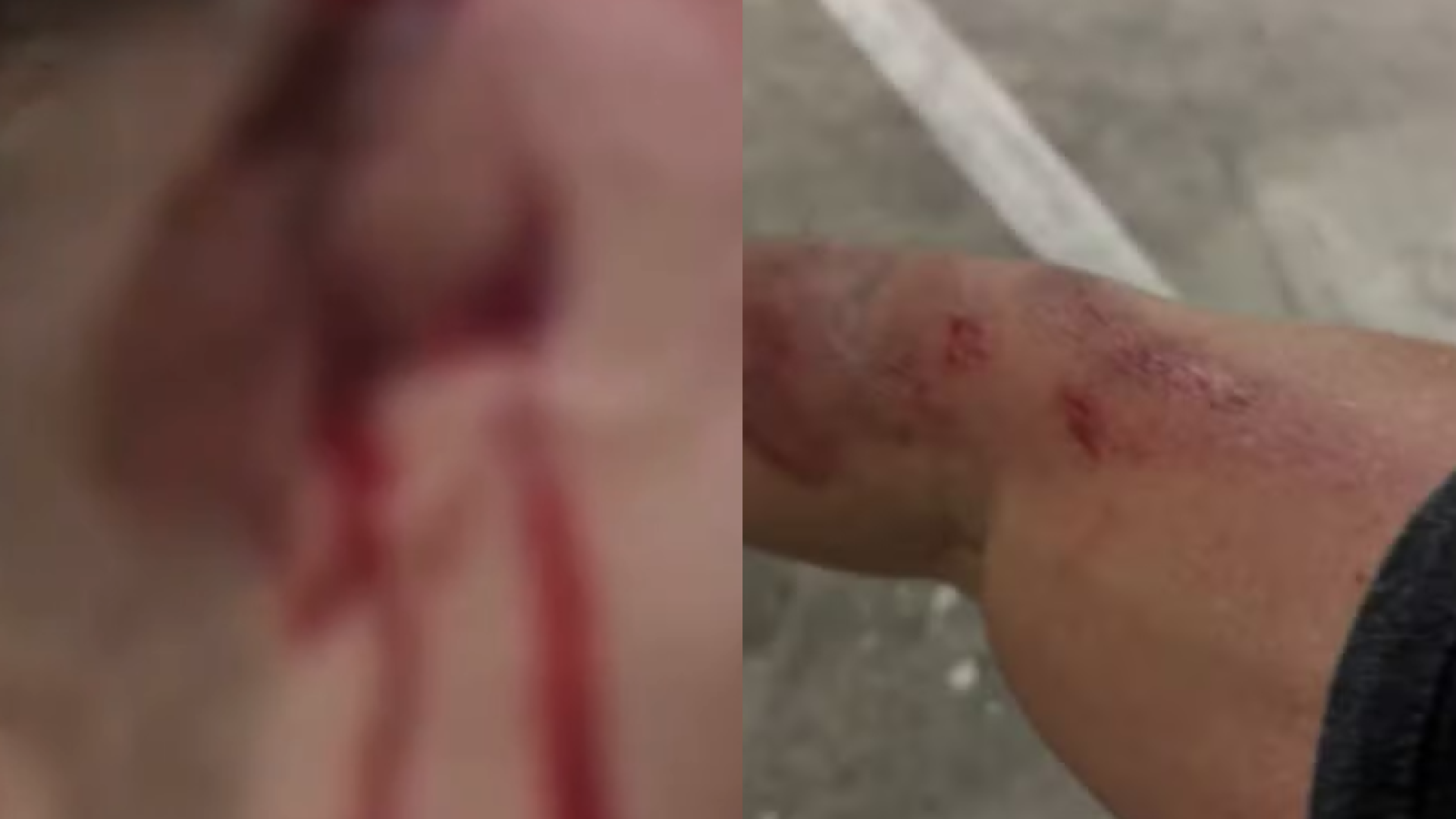 Um guarda-vidas de 35 anos foi assaltado enquanto andava de bicicleta após o expediente em Guarujá, no litoral de São Paulo.