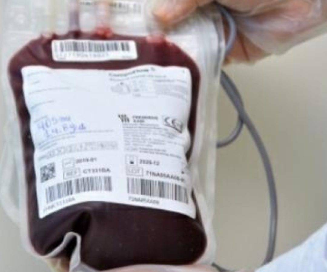 A fila de transplantes no Brasil reúne hoje cerca de 73 mil pacientes, sendo mais da metade à espera de um rim.