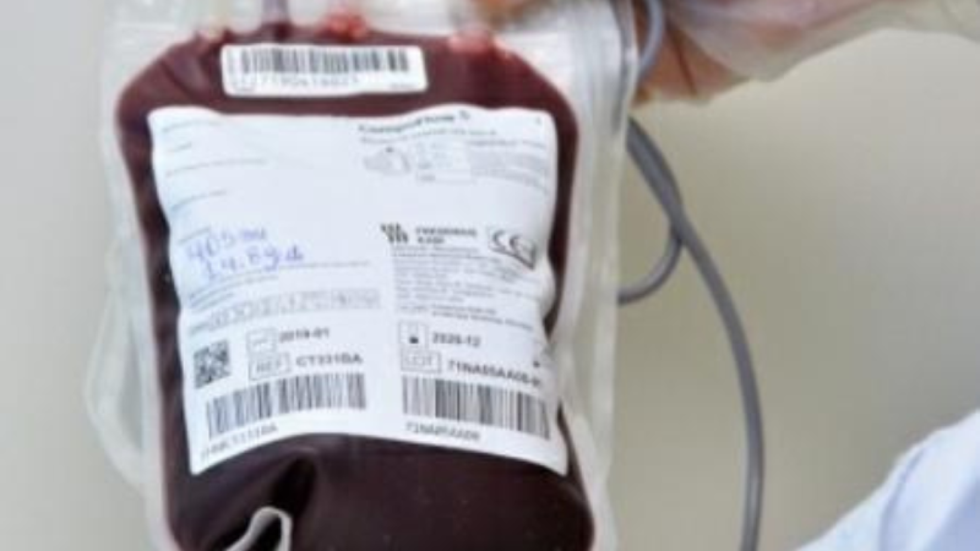A fila de transplantes no Brasil reúne hoje cerca de 73 mil pacientes, sendo mais da metade à espera de um rim.