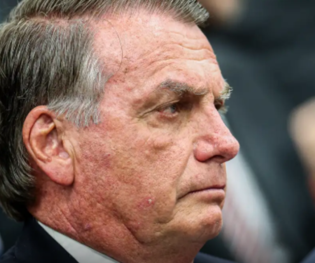 Bolsonaro pede autorização do STF para fazer procedimento médico
