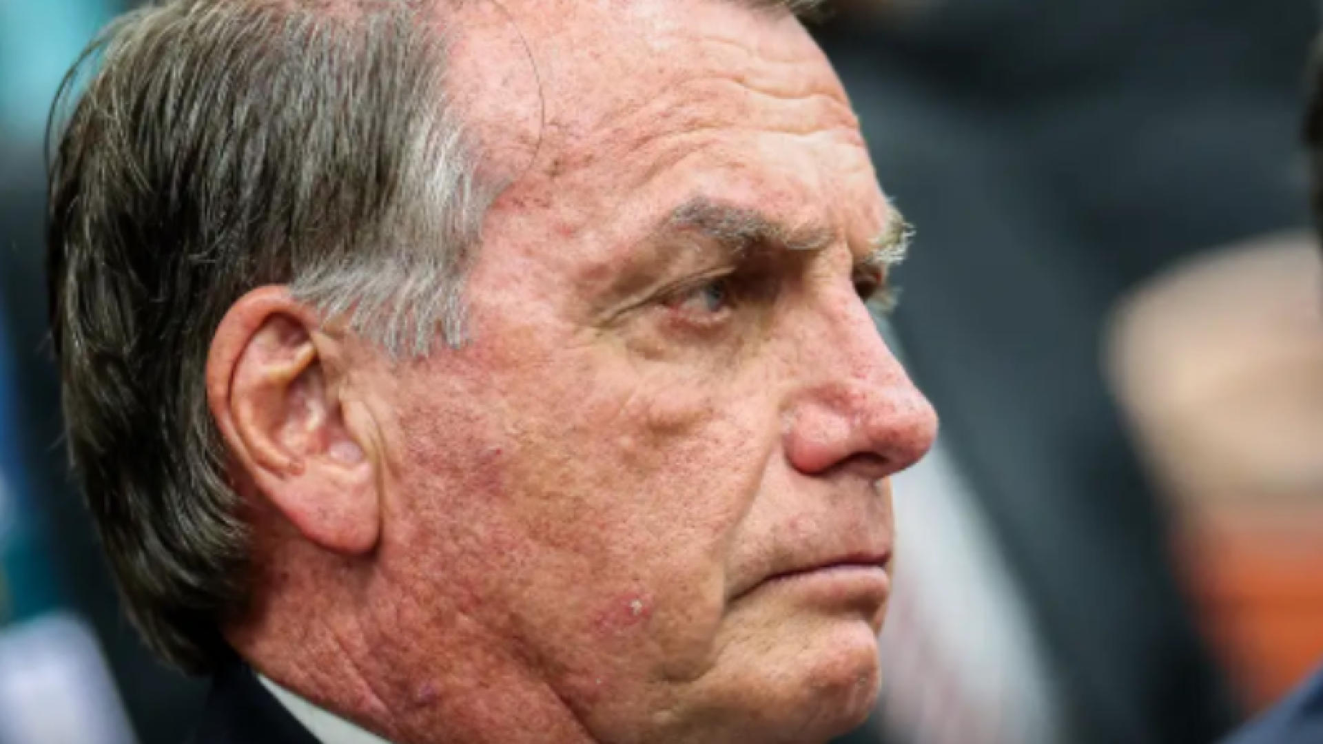 Bolsonaro pede autorização do STF para fazer procedimento médico