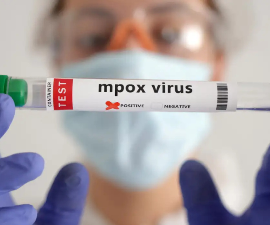 Um ano após a declaração de emergência em saúde pública de importância internacional em razão de um surto na República Democrática do Congo...