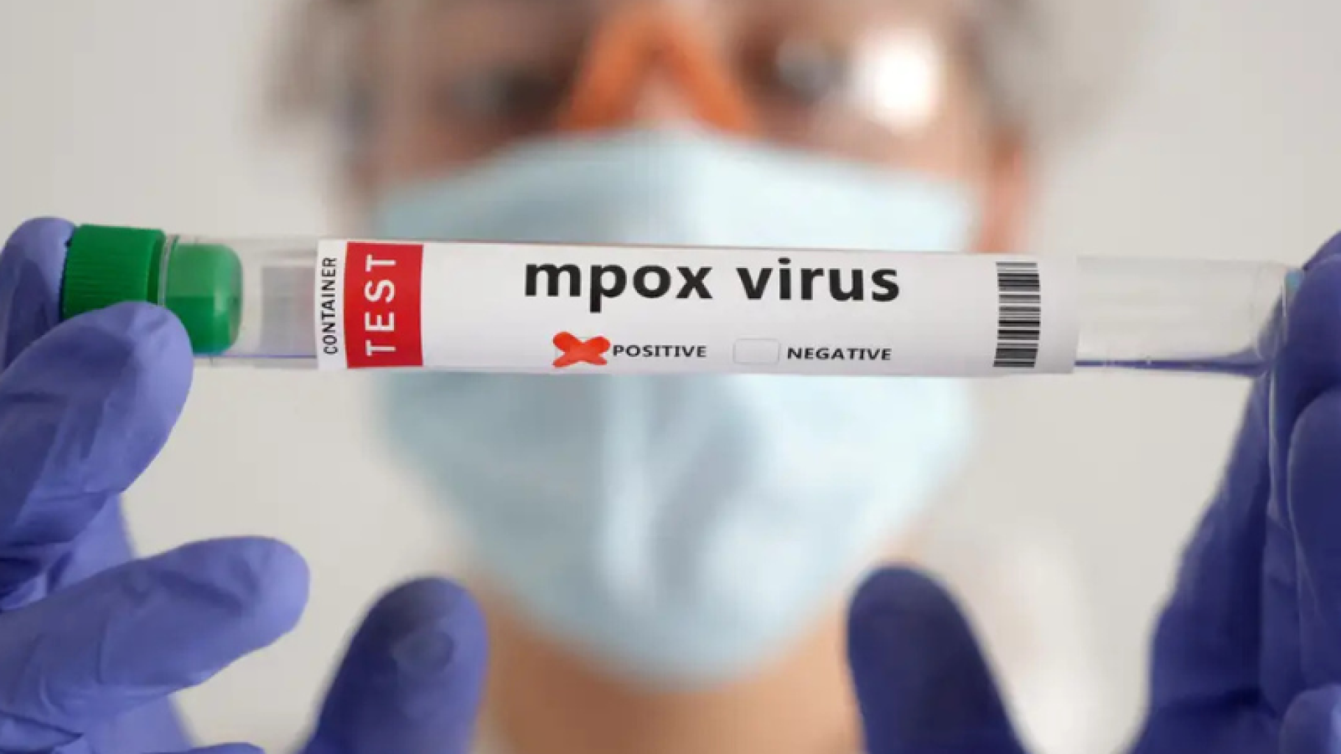 Um ano após a declaração de emergência em saúde pública de importância internacional em razão de um surto na República Democrática do Congo...