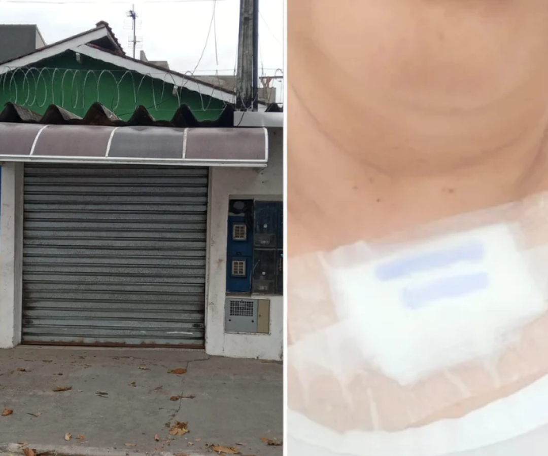 Homem que tentou matar ex-mulher em Peruíbe é preso