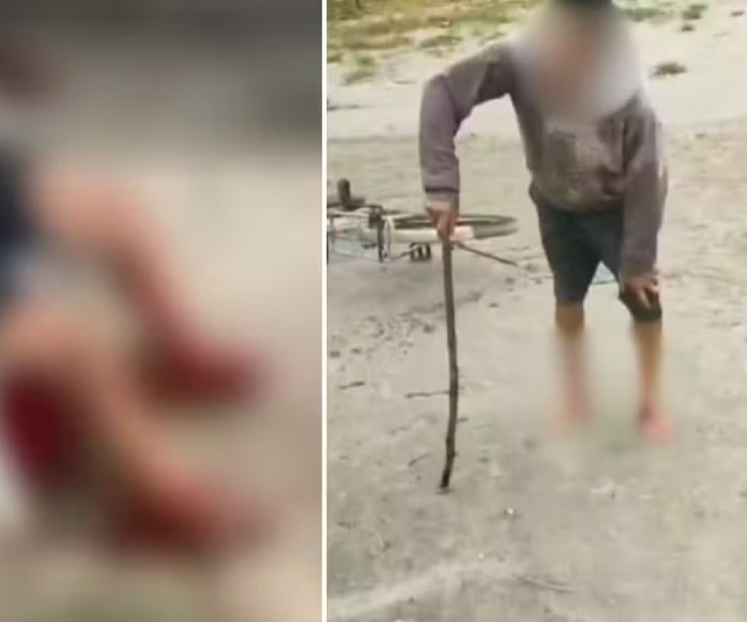 Um homem de 58 anos foi atacado por três cachorros na Praia do Perequê, em Guarujá, no litoral de São Paulo, na última sexta-feira (15).