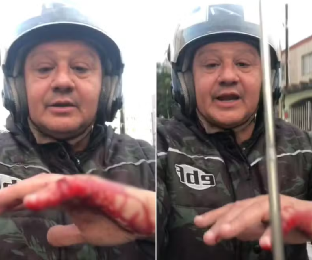 Um motociclista ficou ferido após ser atingido por uma linha de pipa com cerol em São Vicente, no litoral de São Paulo.