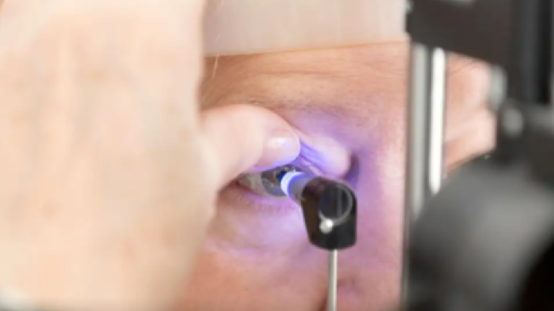 Inteligência artificial pode se tornar aliada no combate ao glaucoma