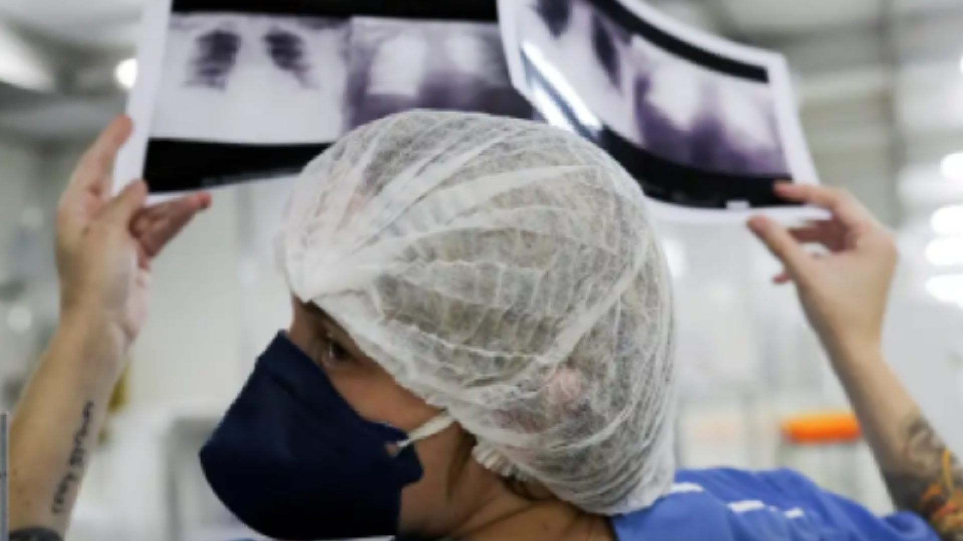 Câncer de pulmão: 15% dos casos acontecem em não fumantes
