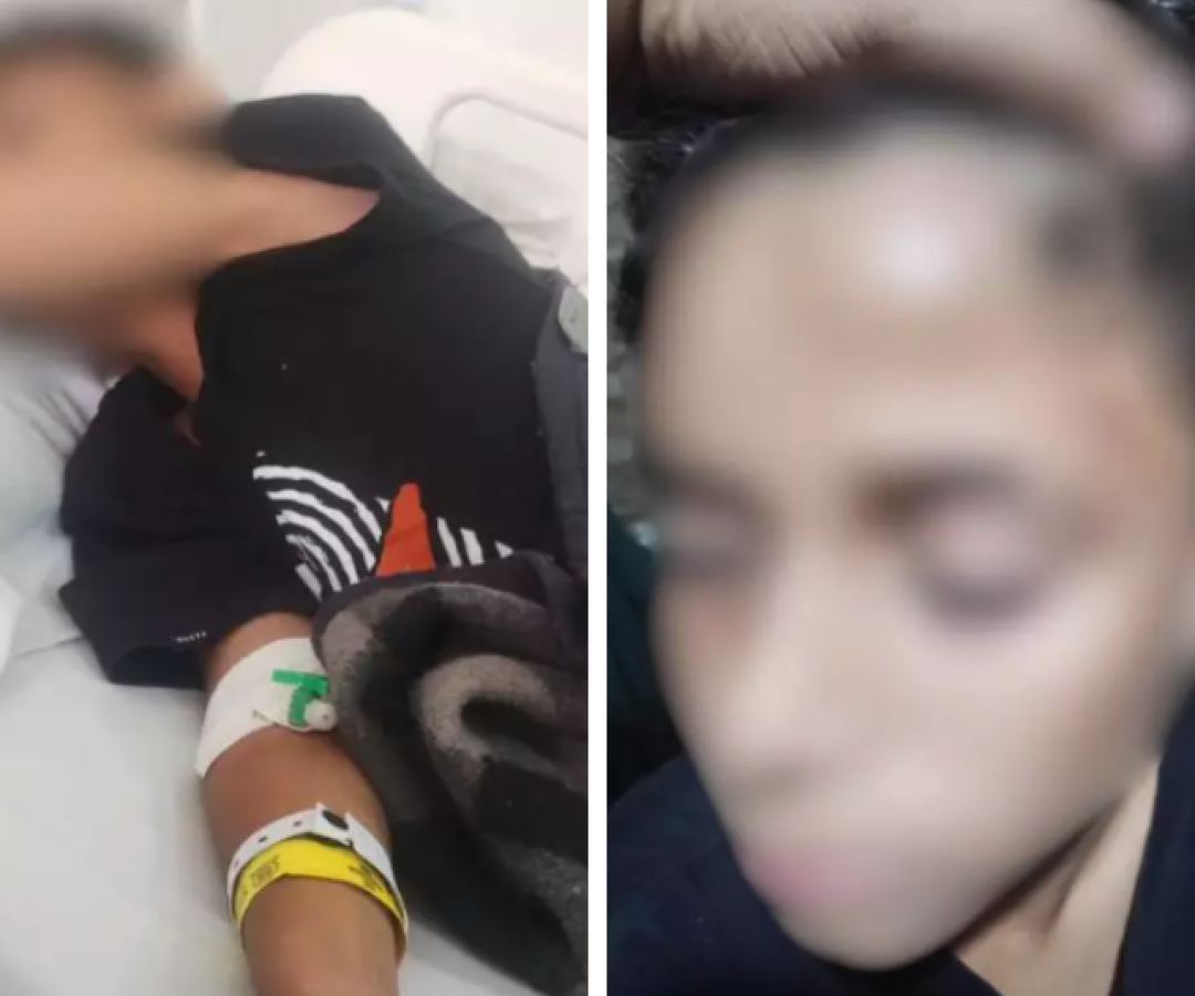 Aluno é agredido dentro de escola e sofre traumatismo craniano em Santos