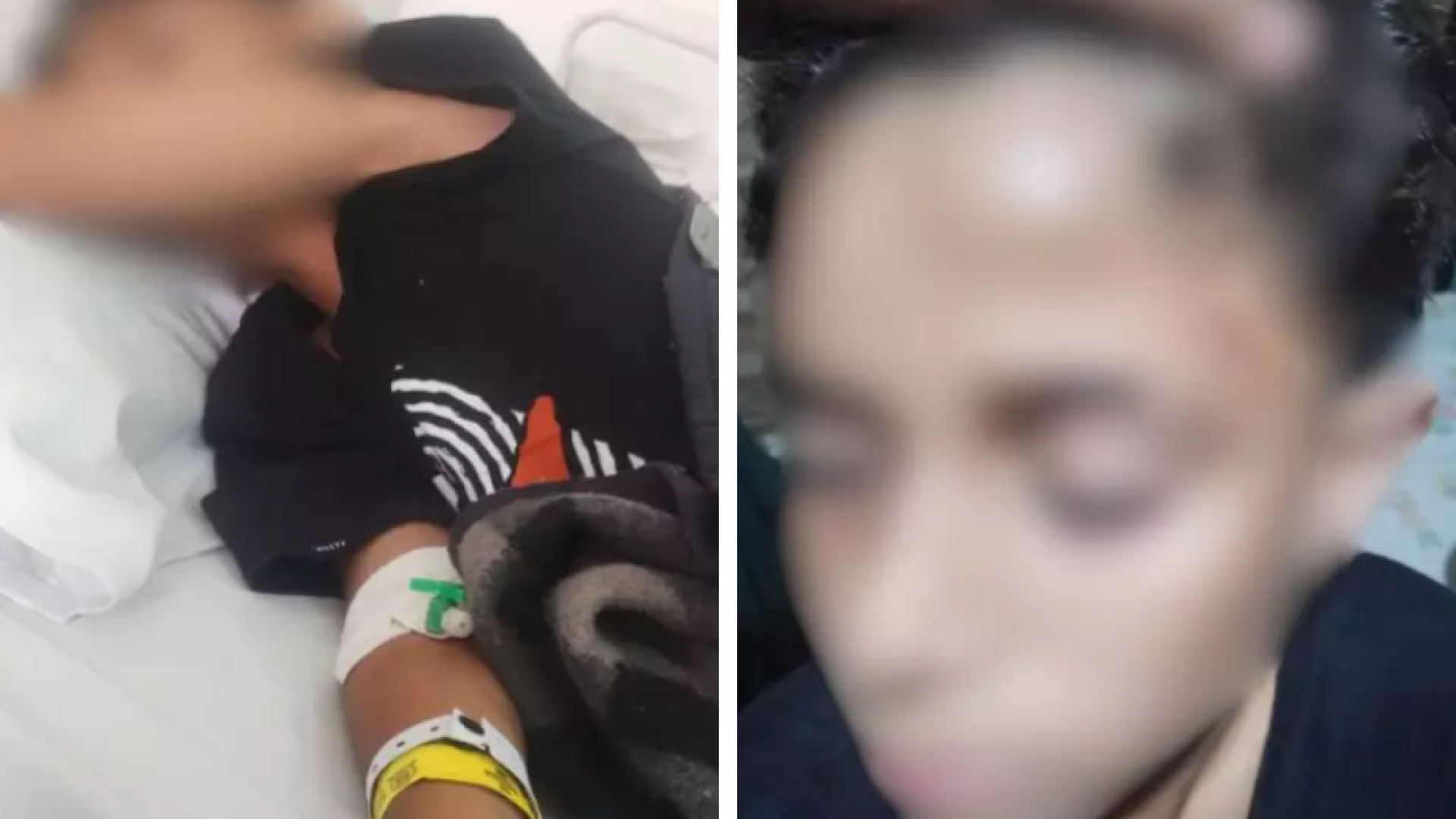 Aluno é agredido dentro de escola e sofre traumatismo craniano em Santos