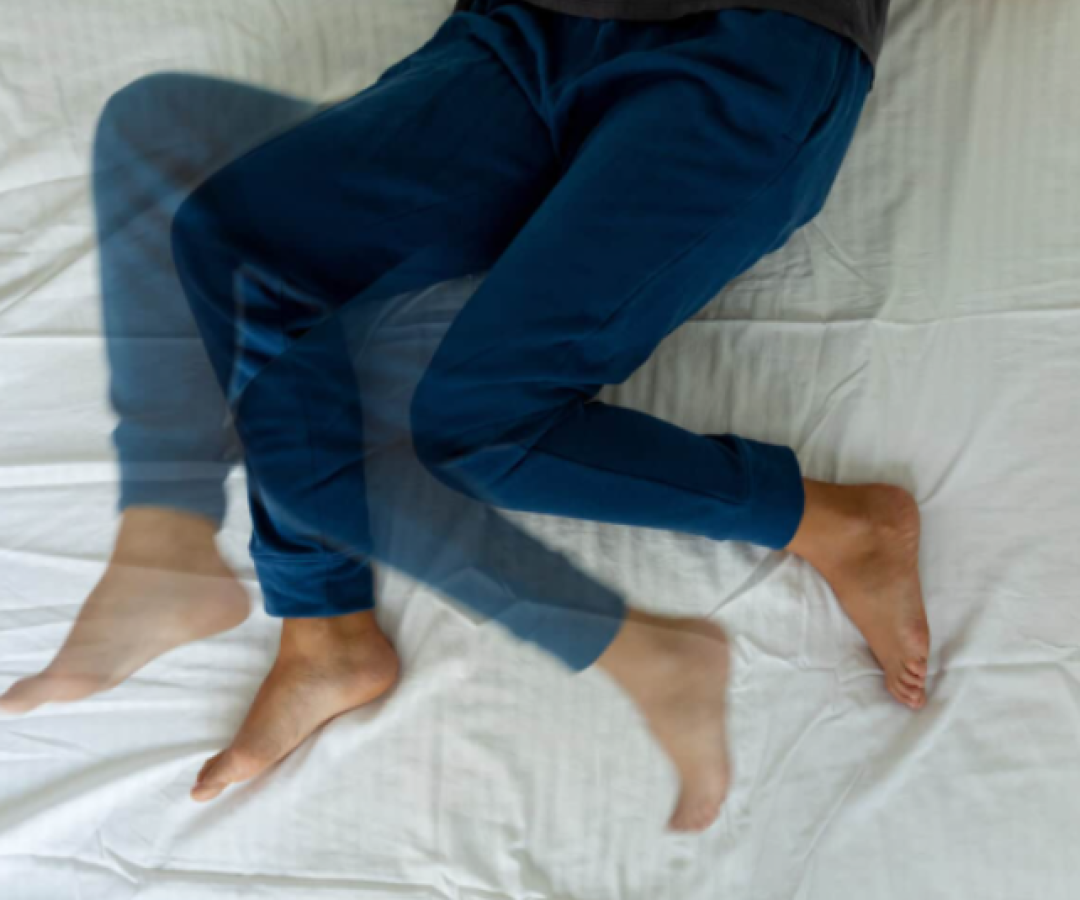 Síndrome das Pernas Inquietas: o que é, sintomas e tratamento