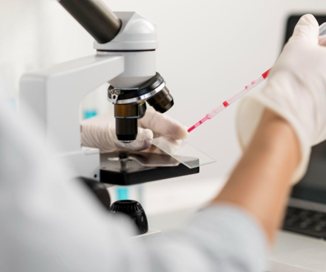 Rastreamento genético identifica predisposição para o câncer de mama anos antes dos primeiros sinais