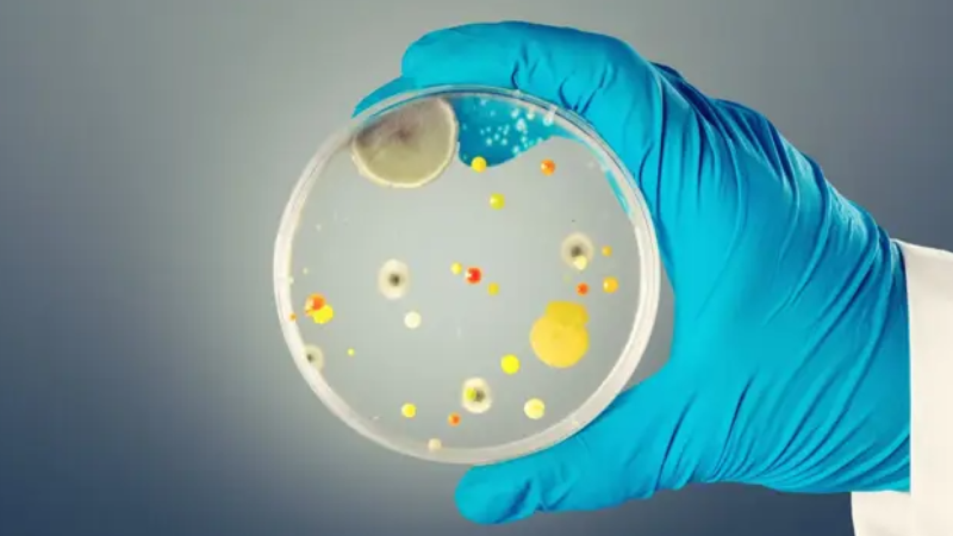 Candida auris: fungo mortal se espalha pela Europa e preocupa autoridades de saúde