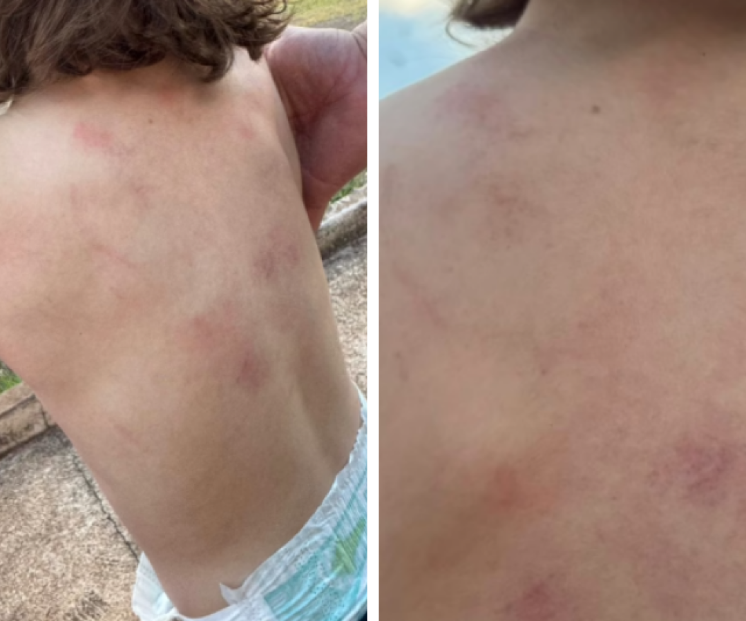 Mãe denuncia agressão contra criança autista na Apae de Ituiutaba; Polícia Civil investiga