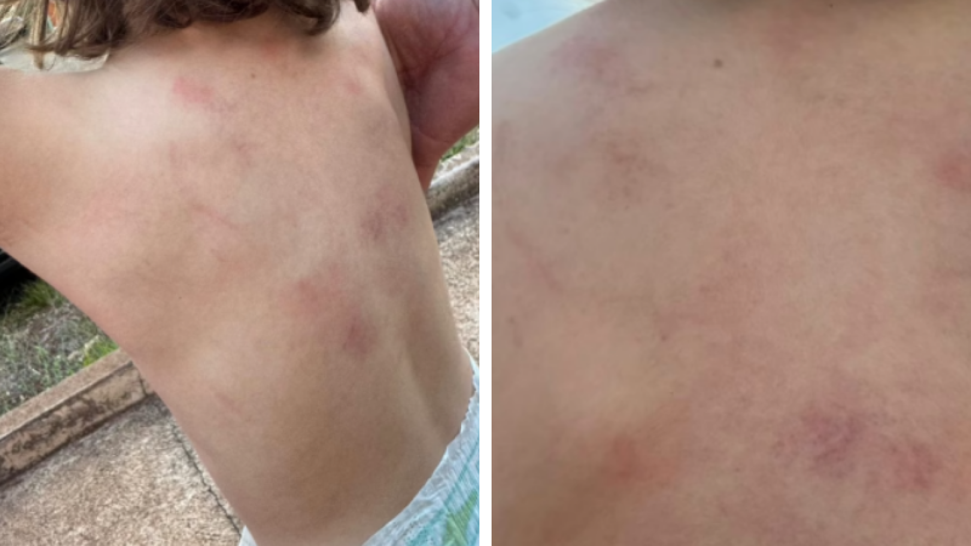 Mãe denuncia agressão contra criança autista na Apae de Ituiutaba; Polícia Civil investiga