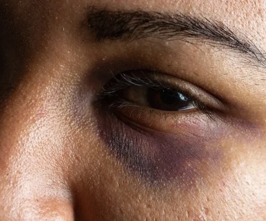 Violencia Contra Mulher Foto: Reprodução