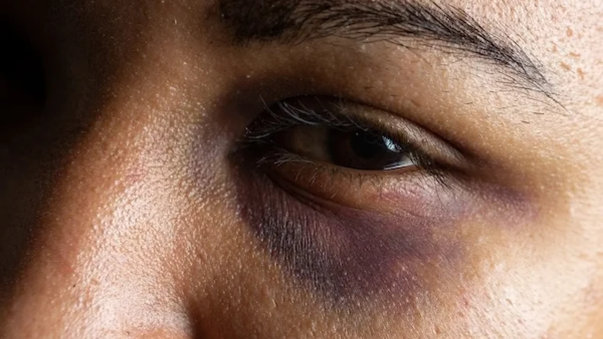 Violencia Contra Mulher Foto: Reprodução