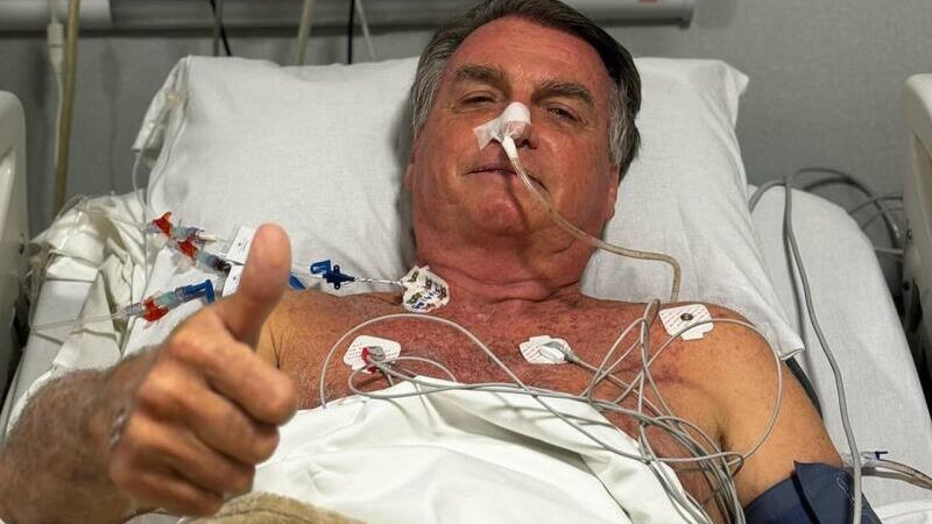 Bolsonaro passa por cirurgia de 12 horas