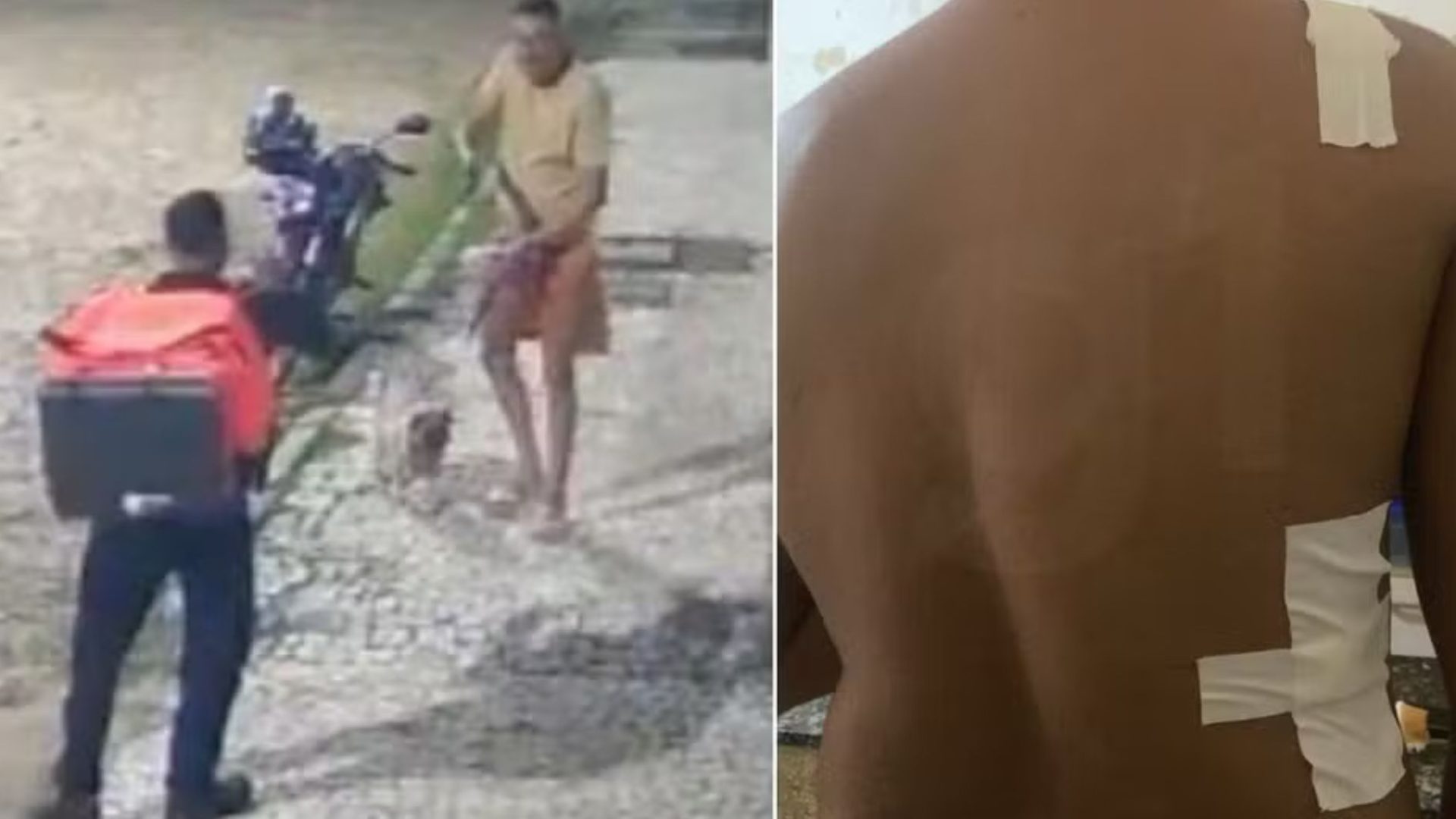 entregador baleado após ser confundido com assaltante