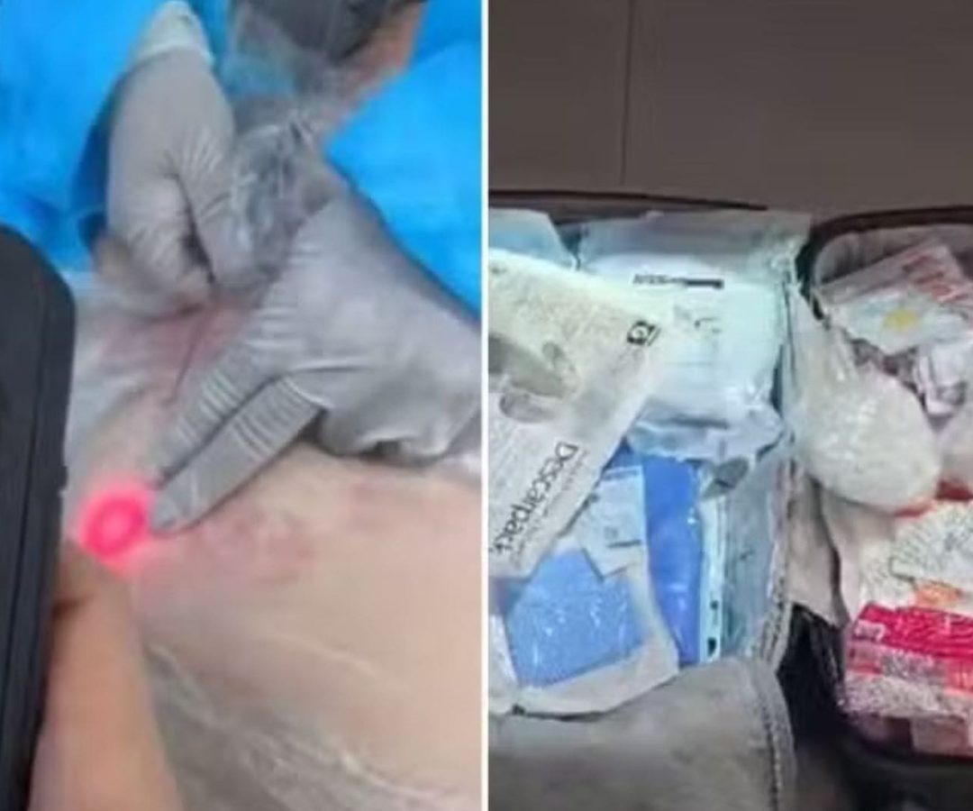esteticista presa em clínica clandestina