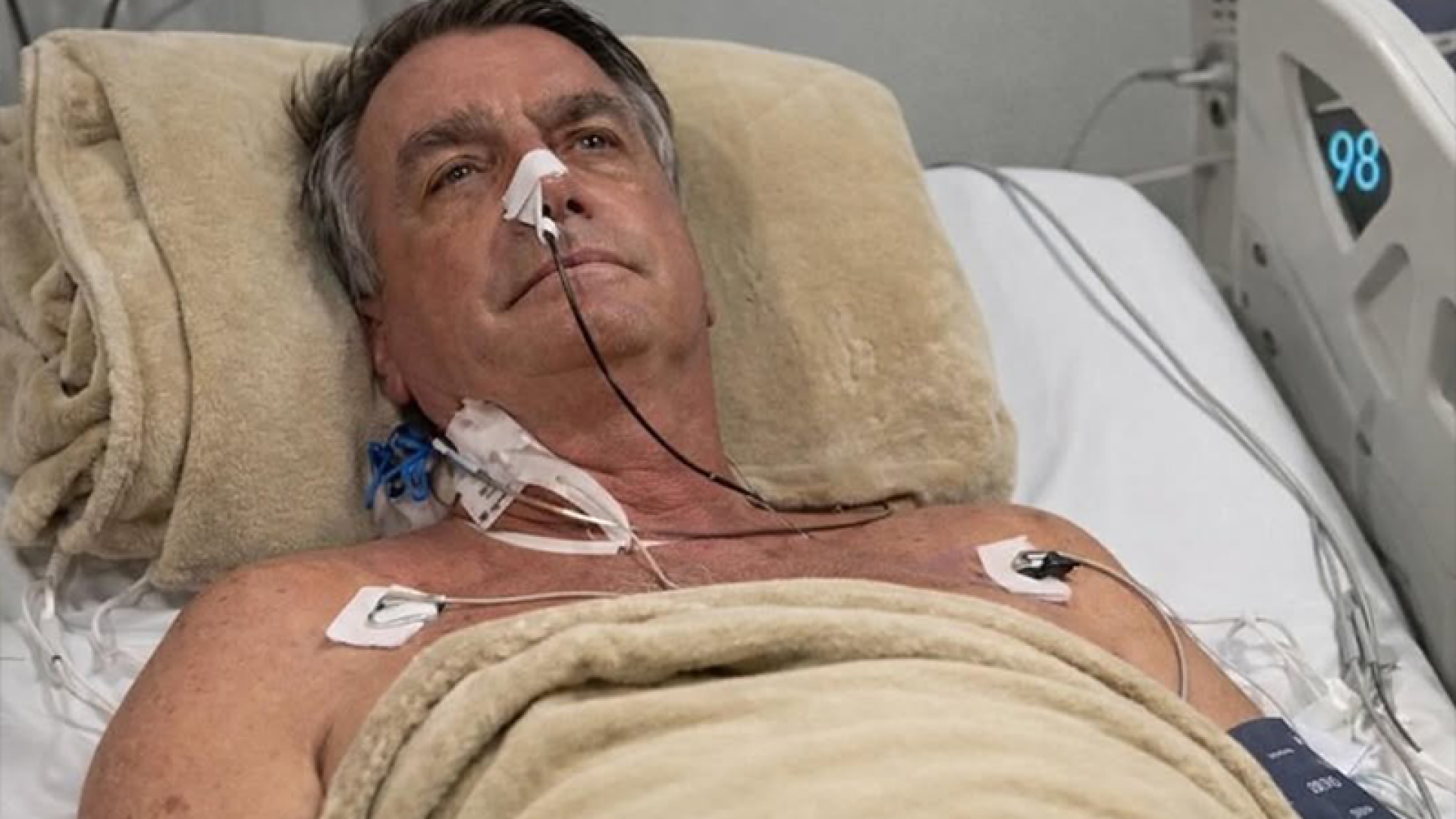 foto bolsonaro pos cirurgia 25 12 25