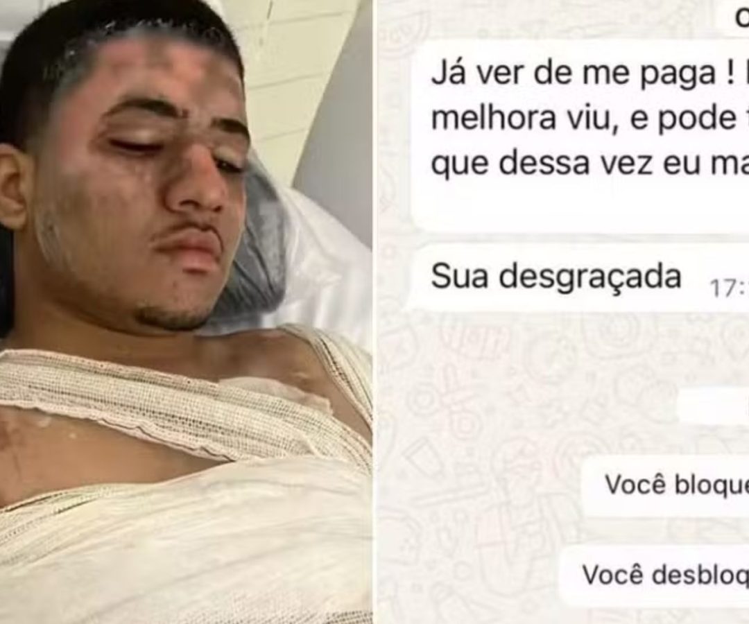 homem queimado em são vicente