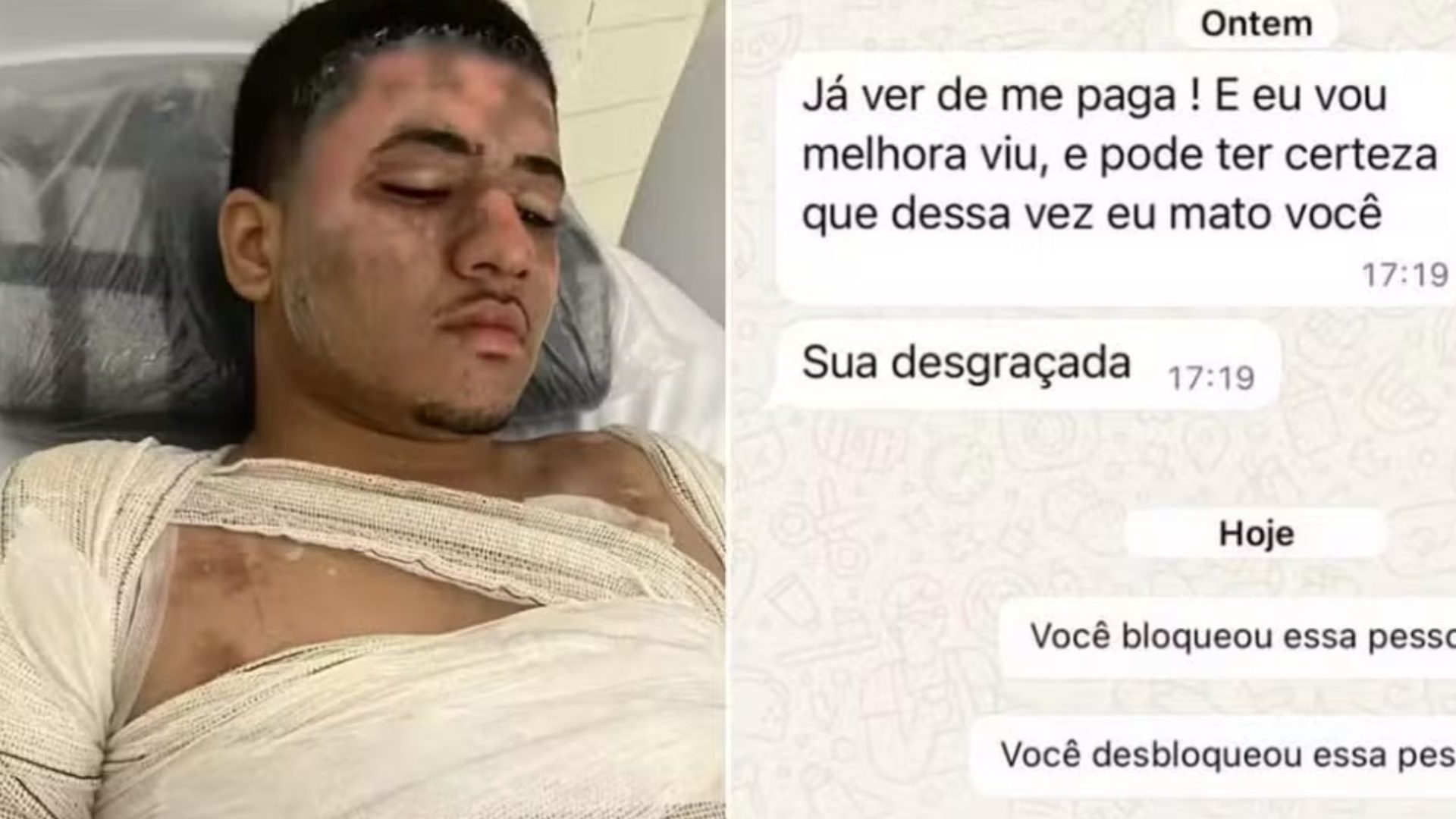 homem queimado em são vicente