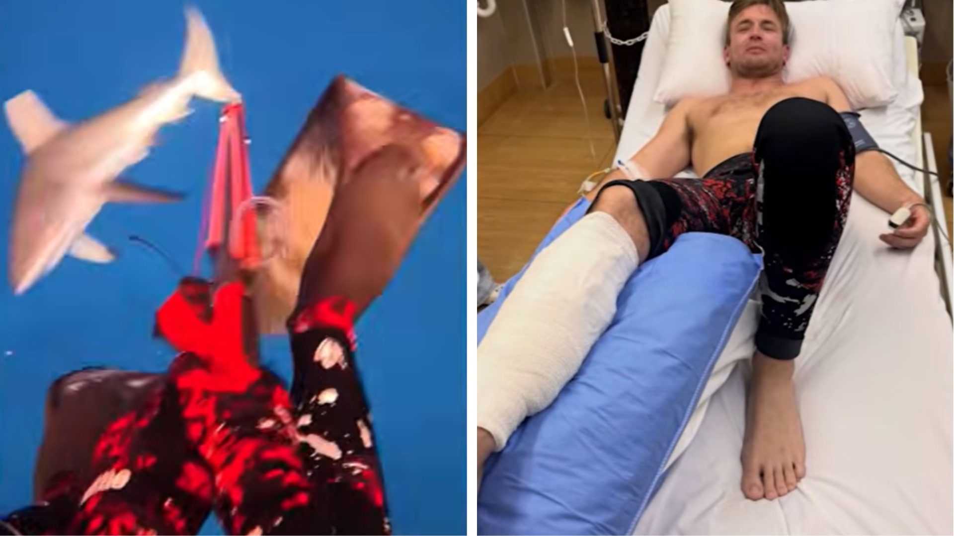mergulhador é mordido por tubarão