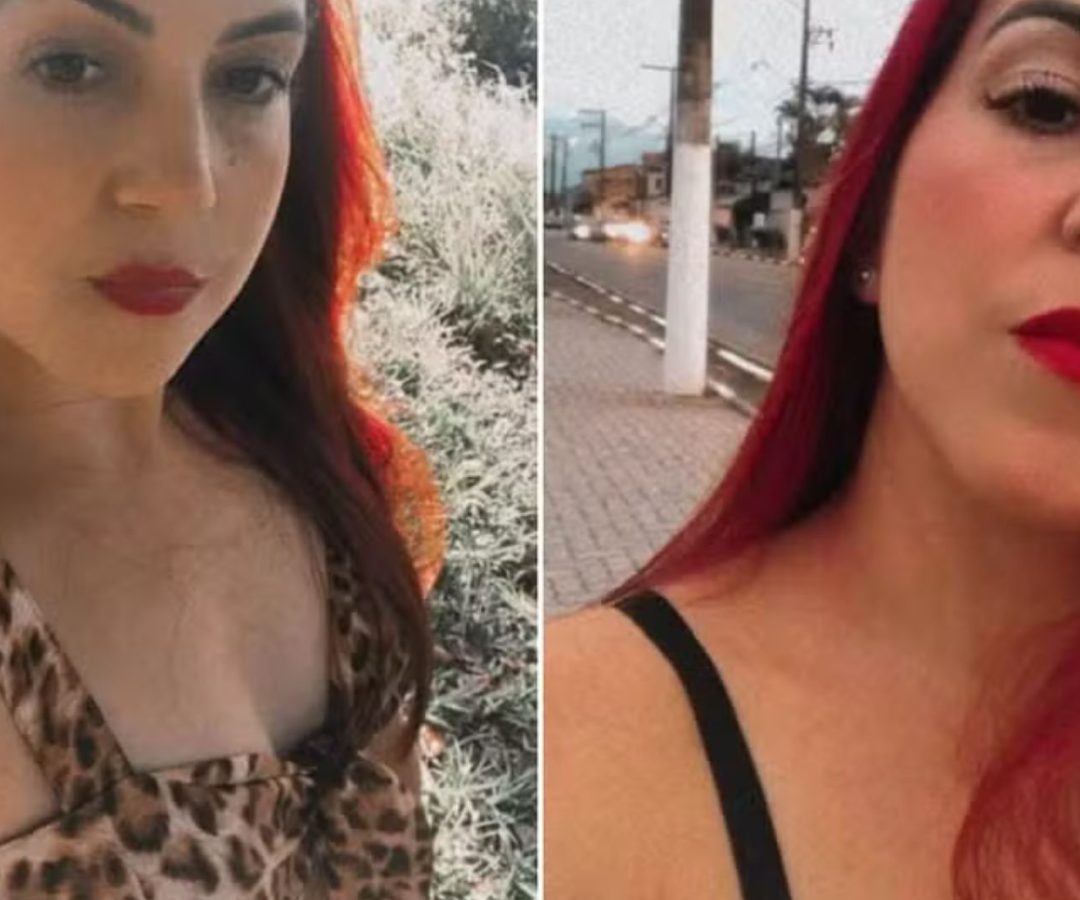 mulher morre após cirurgia plástica
